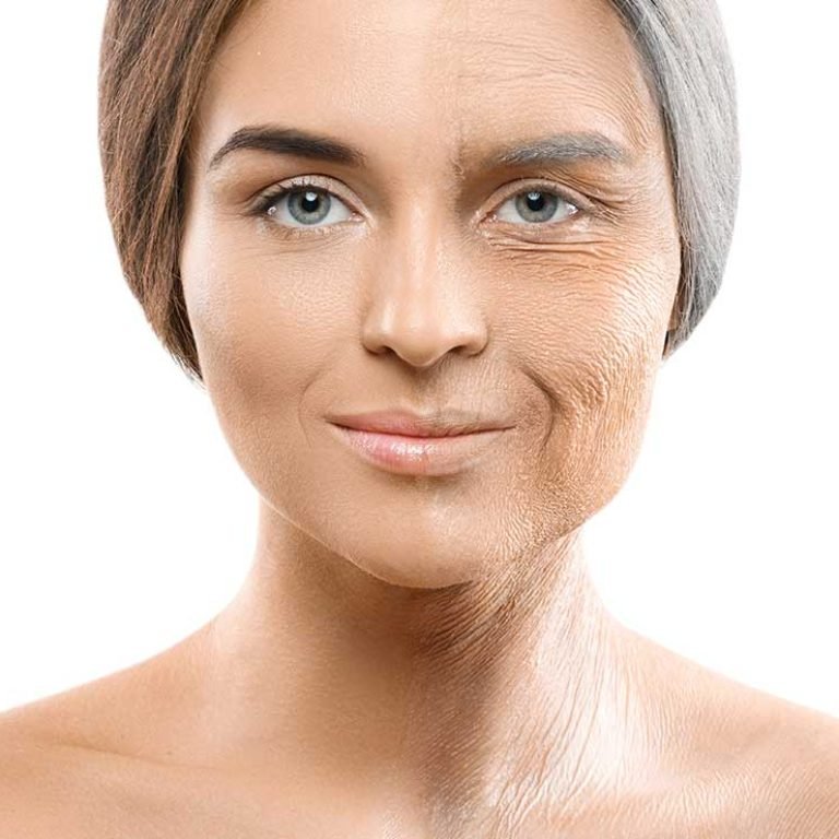 Deep-Plane-Face-Neck-Lift